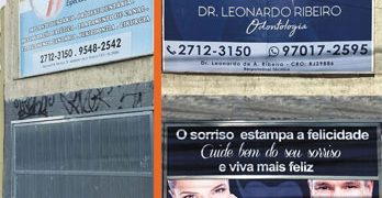 Adesivação de Fachada – Clinica Odontológica