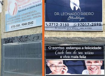 Adesivação de Fachada – Clinica Odontológica